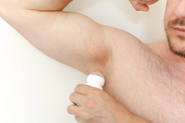 Antitranspirantes con sales de aluminio: cómo actúan en la piel y su seguridad Funcionamiento de los antitranspirantes con sales de aluminio