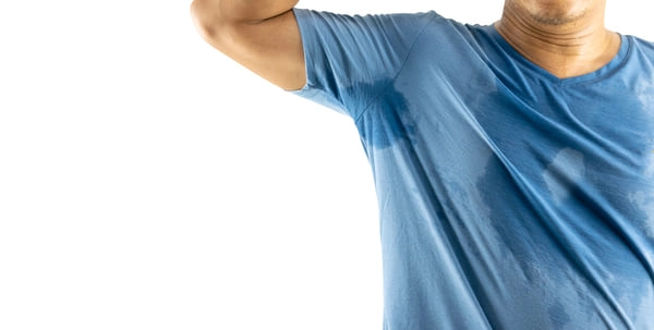 Hiperhidrosis en hombre afectado por la condición - Colombia No Sweat